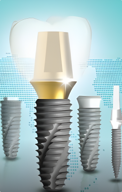 Zubné implantáty