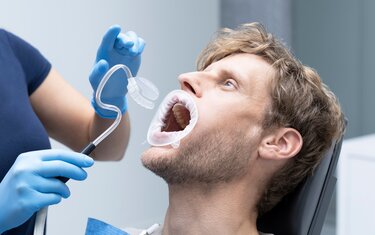 Ivoclar OptraGate Dry Control