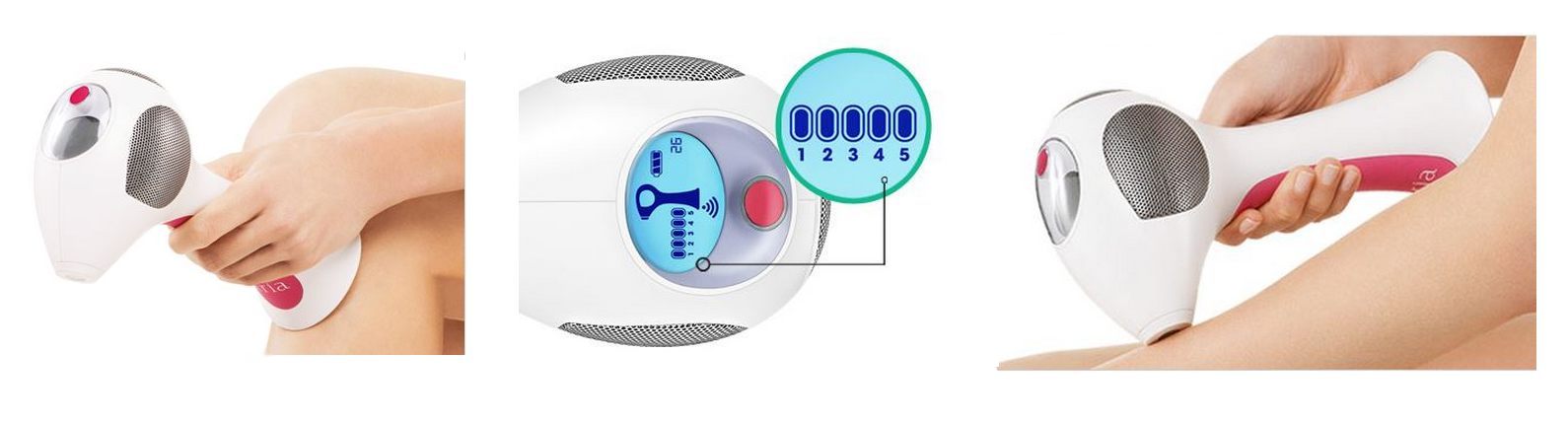 tria laser domaci epilace