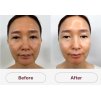 SkinGlow Mask Medisco
