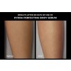 BEFORE AFTER Hydra perfecting body serum (2)
