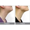 Rio Beauty Přístroj na zpevnění krku a brady NECK4