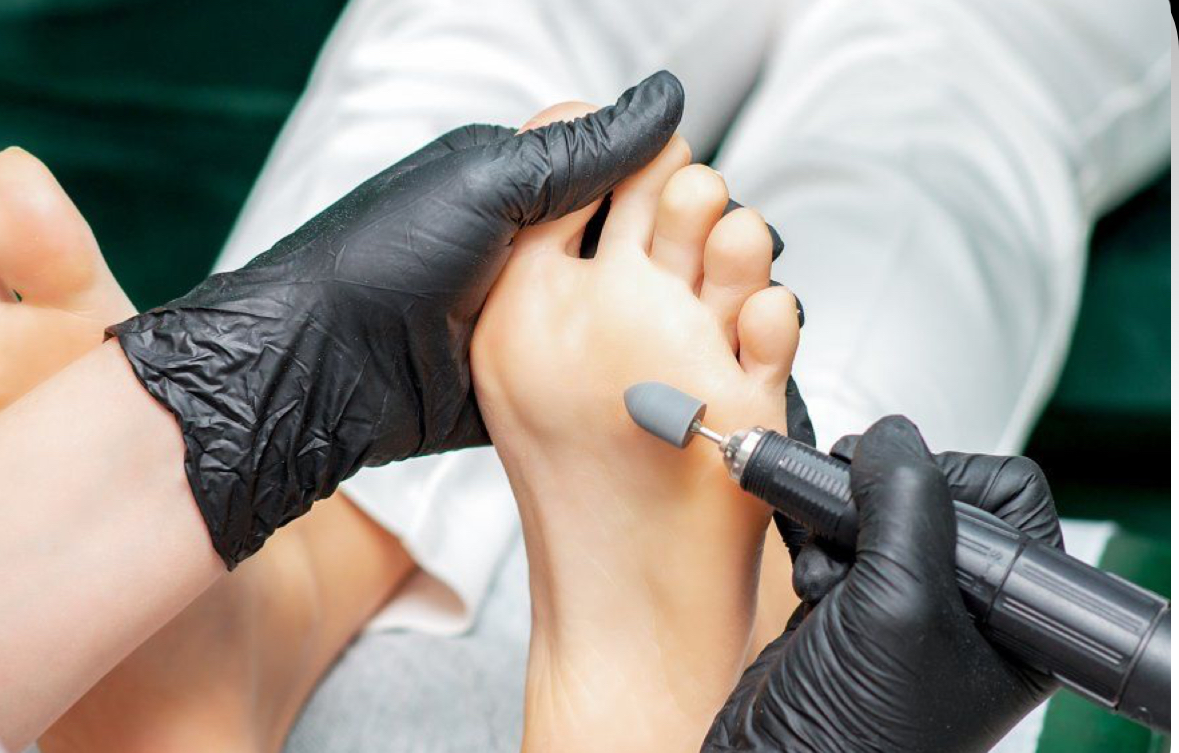 Pedikúra přístrojová