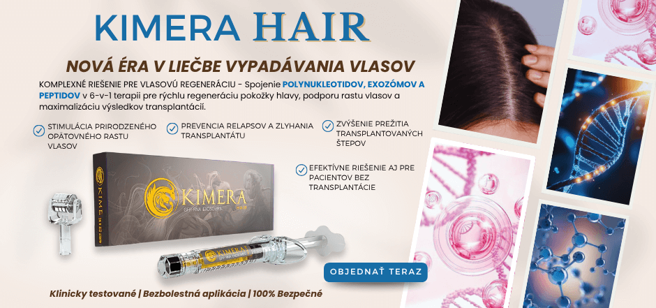 Kimera HAIR