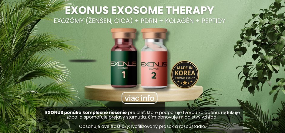 Exonus