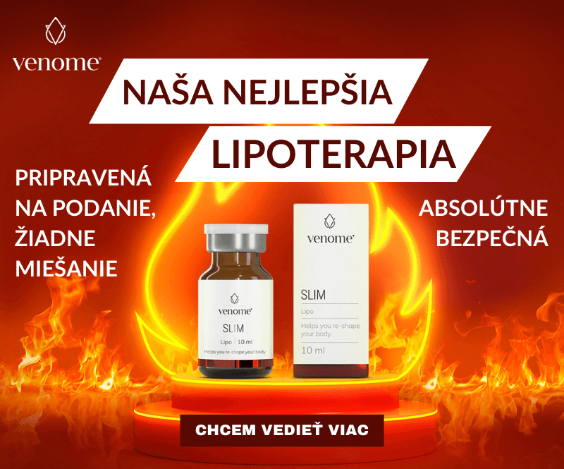 VENOME SLIM LIPO MOBIL