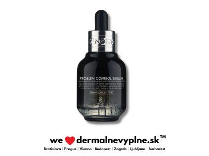 genosys problem control serum SK