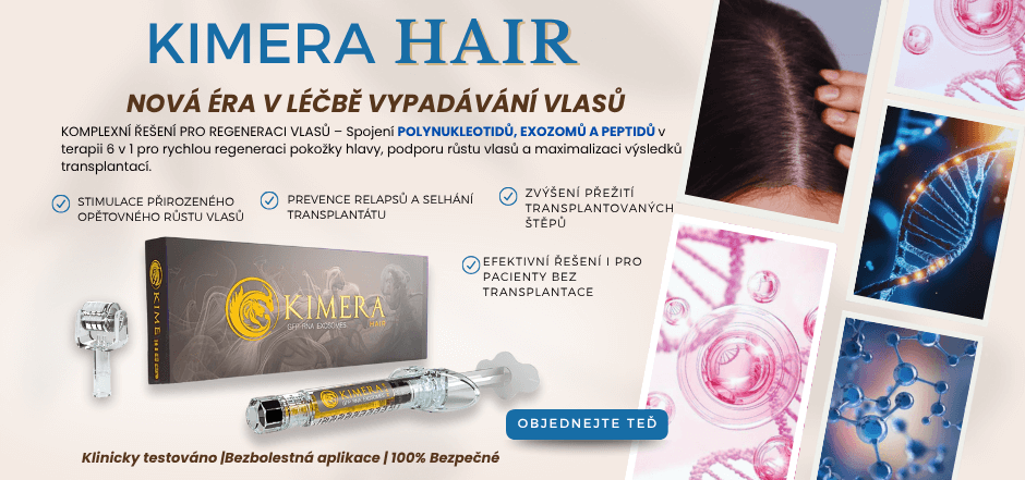 Kimera HAIR