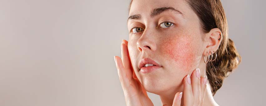 4 ways to get sensitive skin under control