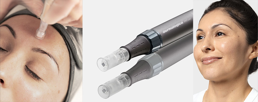 NanoInfusion Treatment