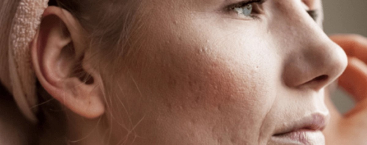 Proč se vám tvoří záněty?