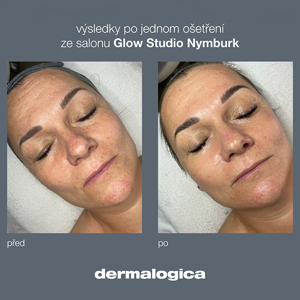 Ošetření Dermalogica LuminFusion