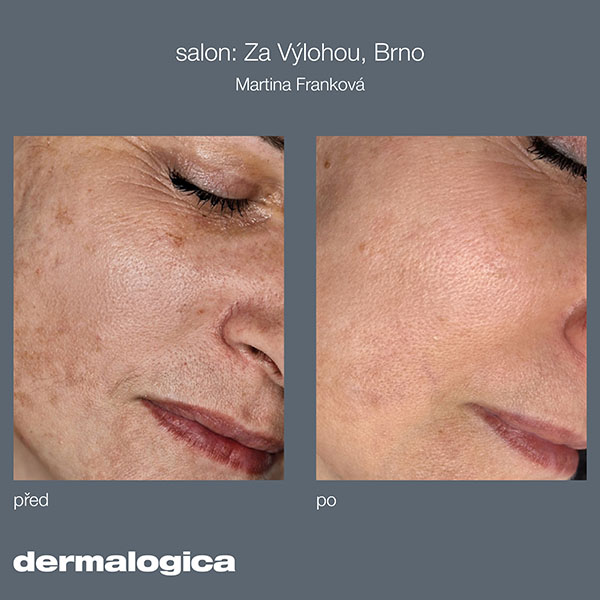Ošetrenie Dermalogica ExoBooster