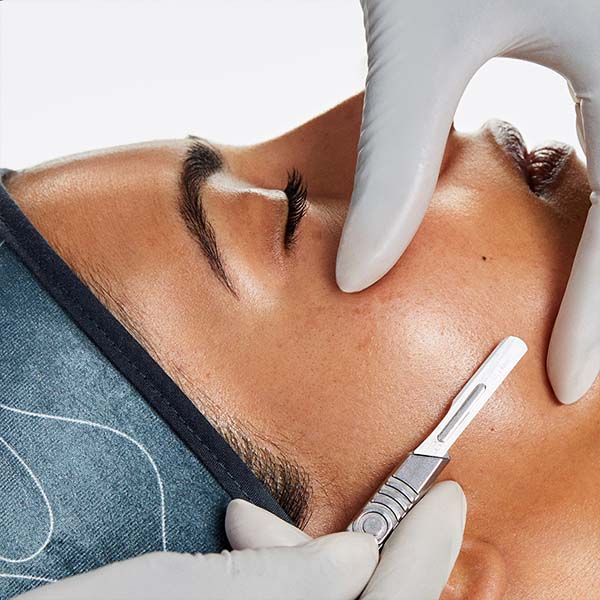 Dermaplaning ošetření