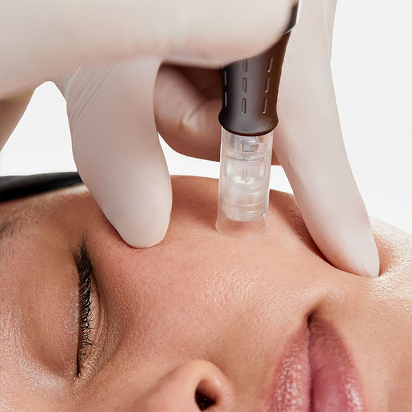 Dermaplaning ošetření