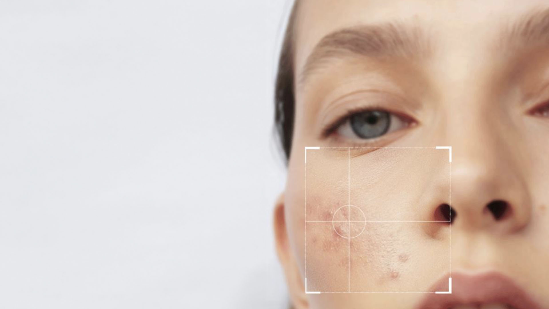 Dermalogica ProClear treatment