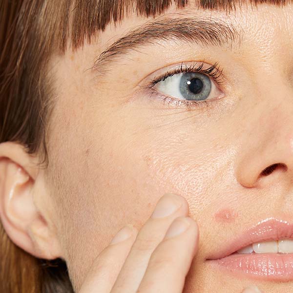 Dermaplaning ošetření