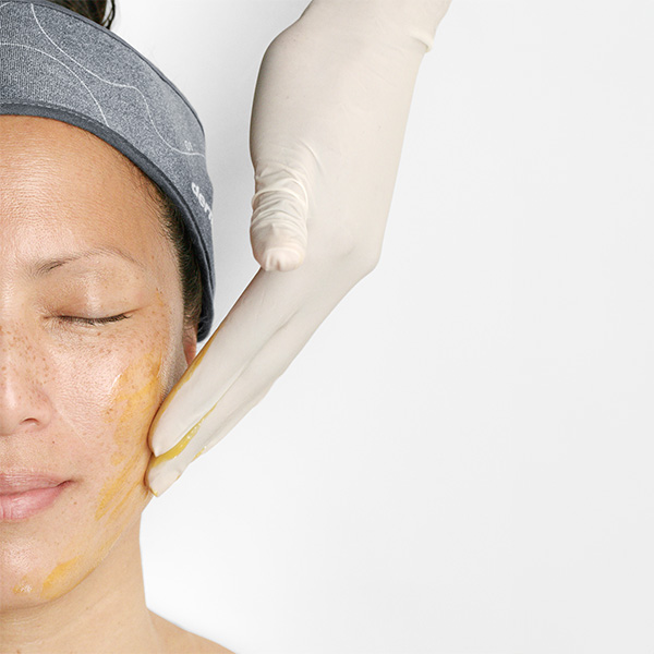 Dermaplaning ošetření