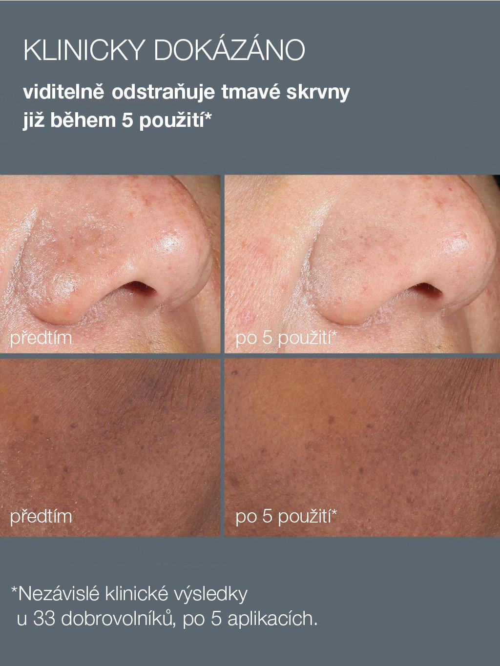 dermalogica-powerbright-dark-spot-peel-50-ml-peeling-zmirnujici-hyperpigmentaci-7