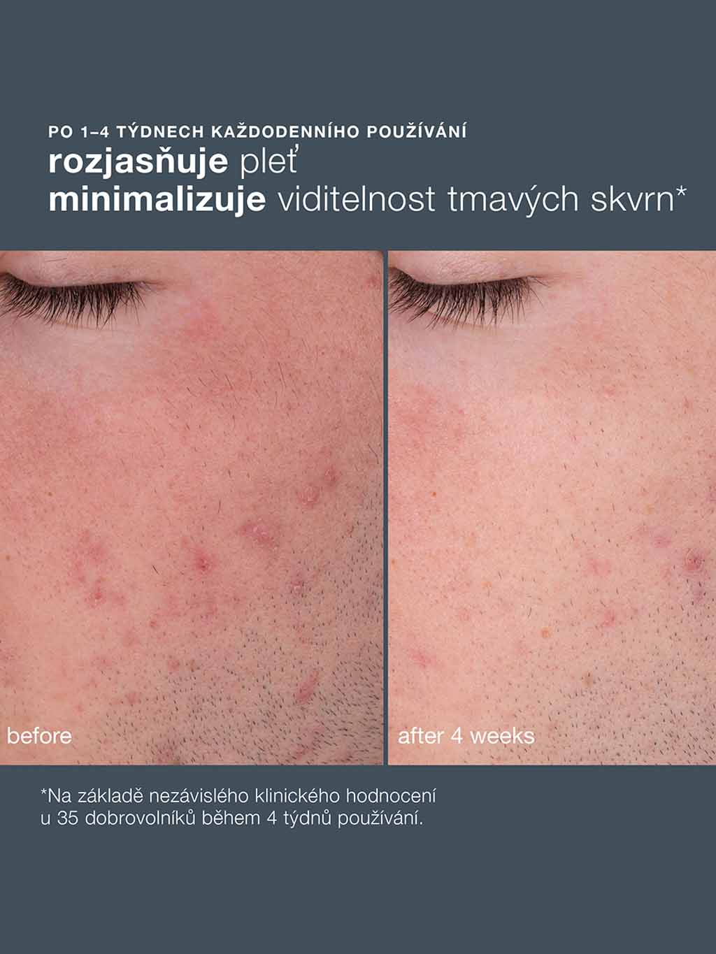 Daily Microfoliant, 13 g (obrázek 6)