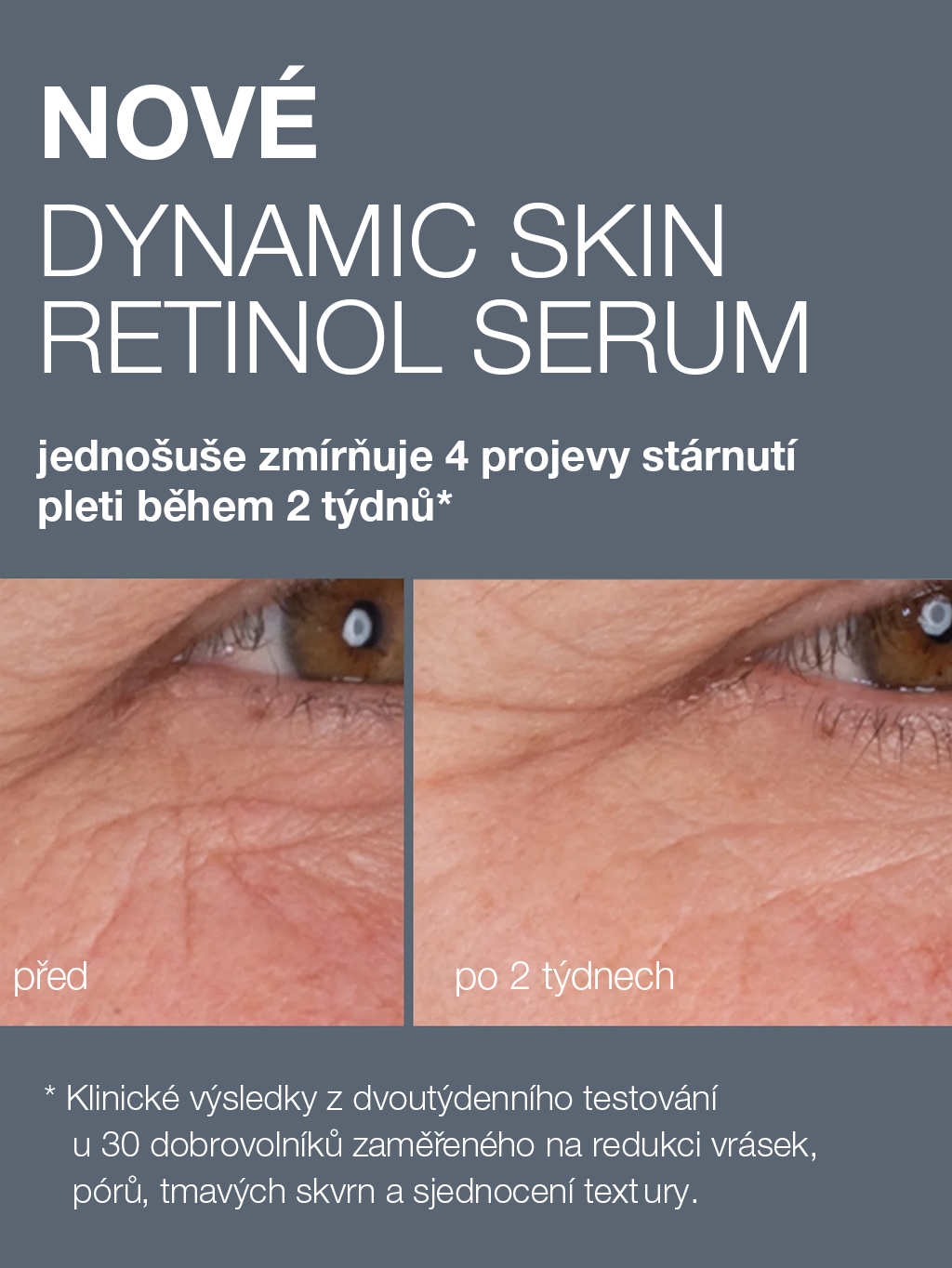 Dynamic Skin Retinol Serum, 10 ml - Obrázek 4