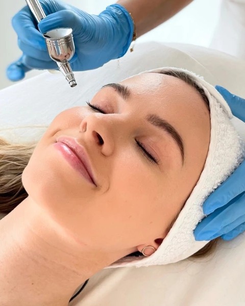 dermaoxy_zabieg4-2_1