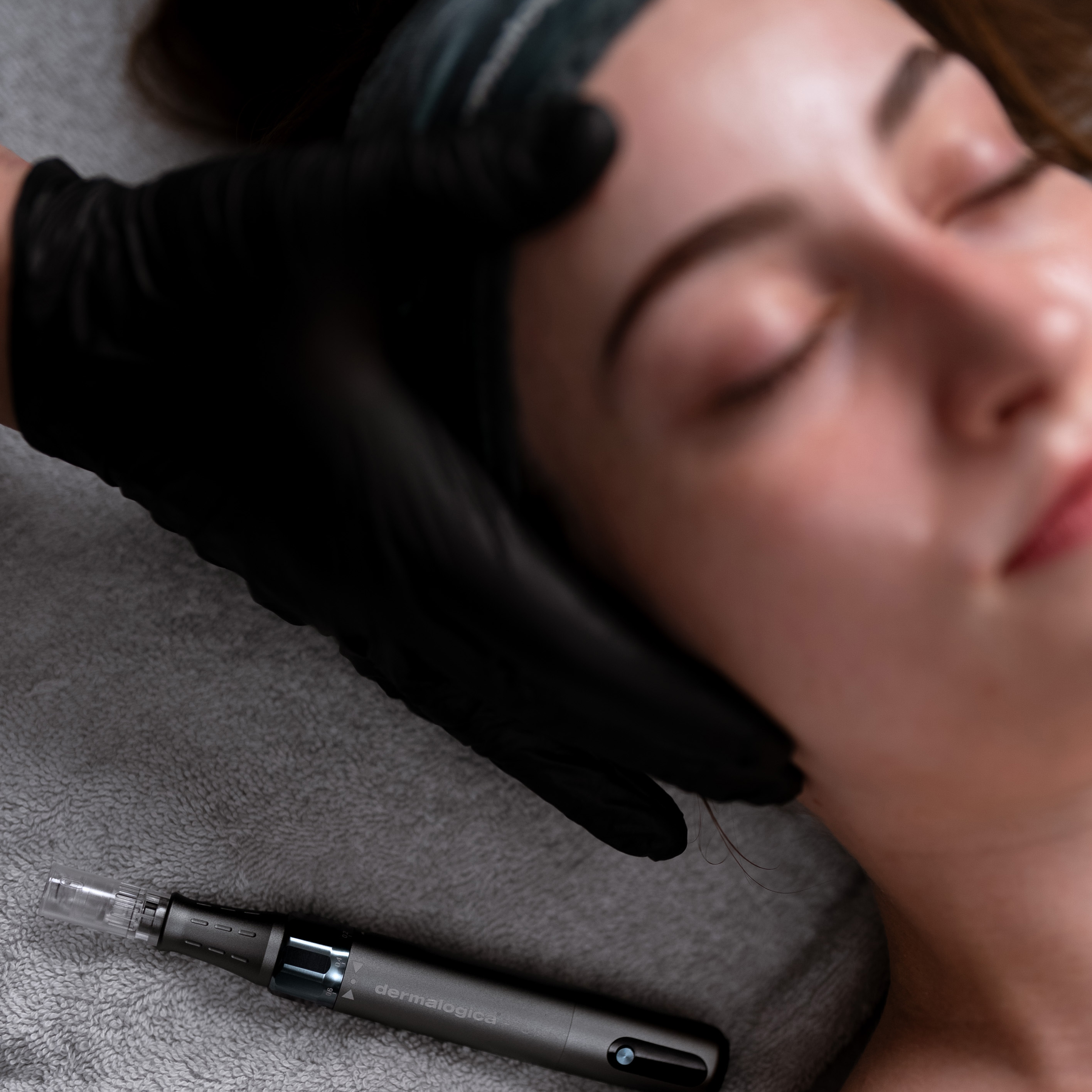 Dermastudio - Omlazení pleti a regenerace