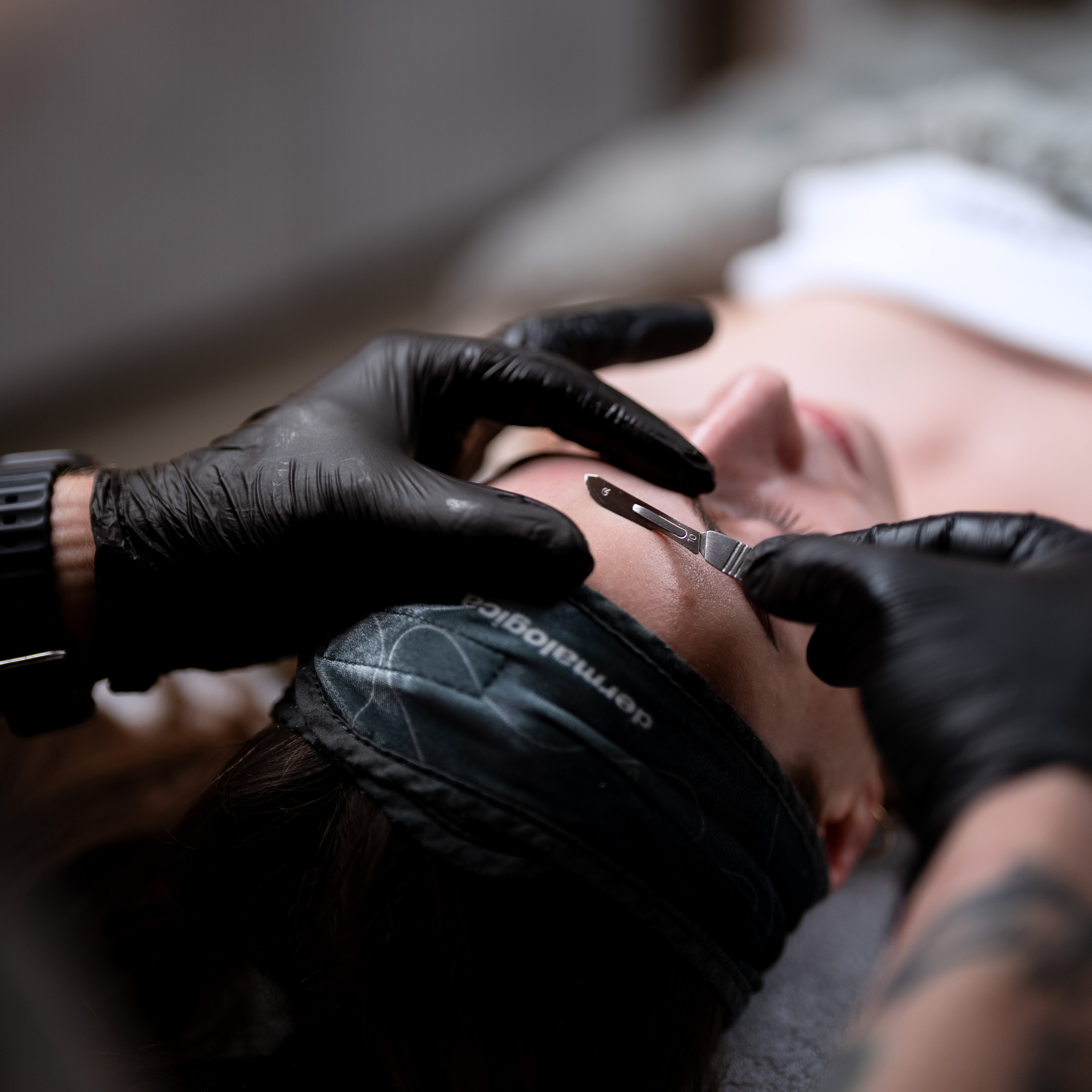 Dermaplaning