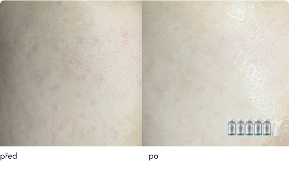 DermaThod