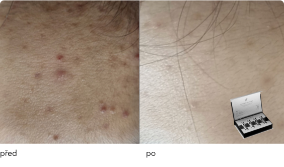 DermaThod