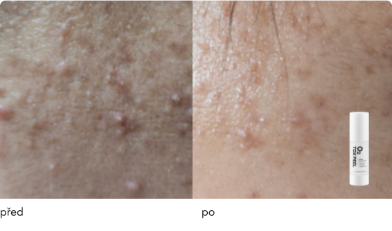 DermaThod