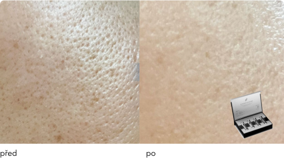 DermaThod