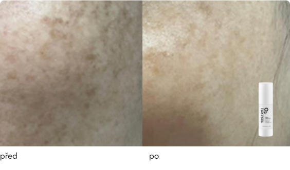 DermaThod