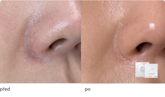 DermaThod