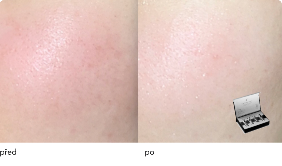 DermaThod