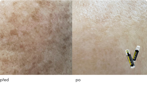 DermaThod