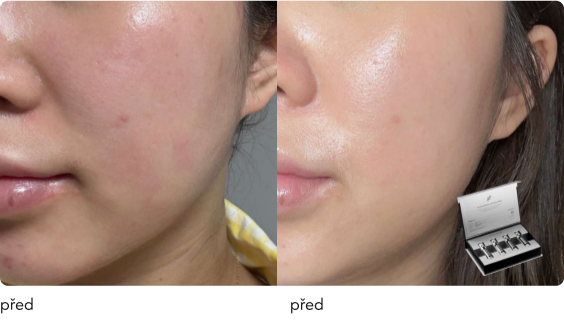 DermaThod