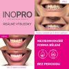 INOPRO - Green Whitening Strips Spirulina  Šetrné bělící pásky s rostlinnými složkami