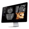 CBCT KaVo OP3D stáří 4 roky