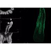 invivo6EndodonticVisualization