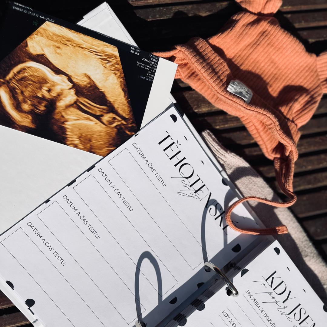 10 důvodů, proč si v těhotenství vést diář