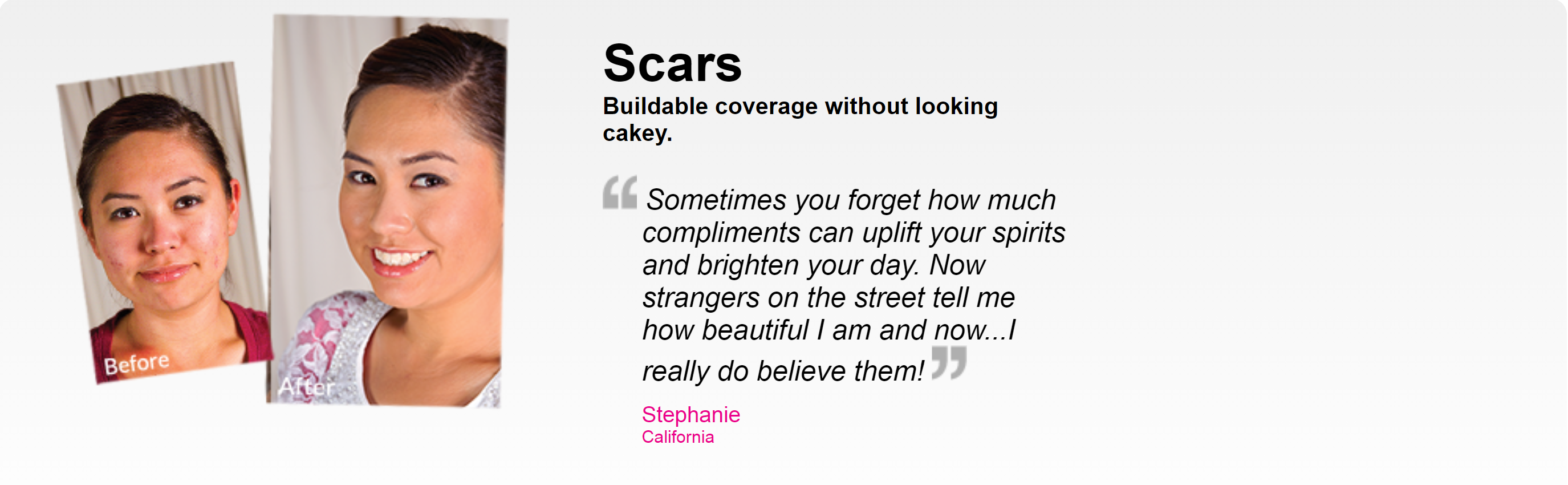 Scars