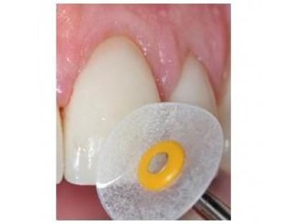 OPTIDISC (100 ks), délky 9,6 mm různé hrubosti