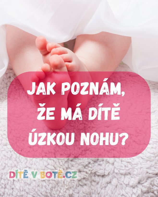 🦶 Jak poznám, že má dítě ÚZKOU NOHU? Ne každá nožka potřebuje široké boty. Některé děti mají nohu úzkou – a ve špatném...