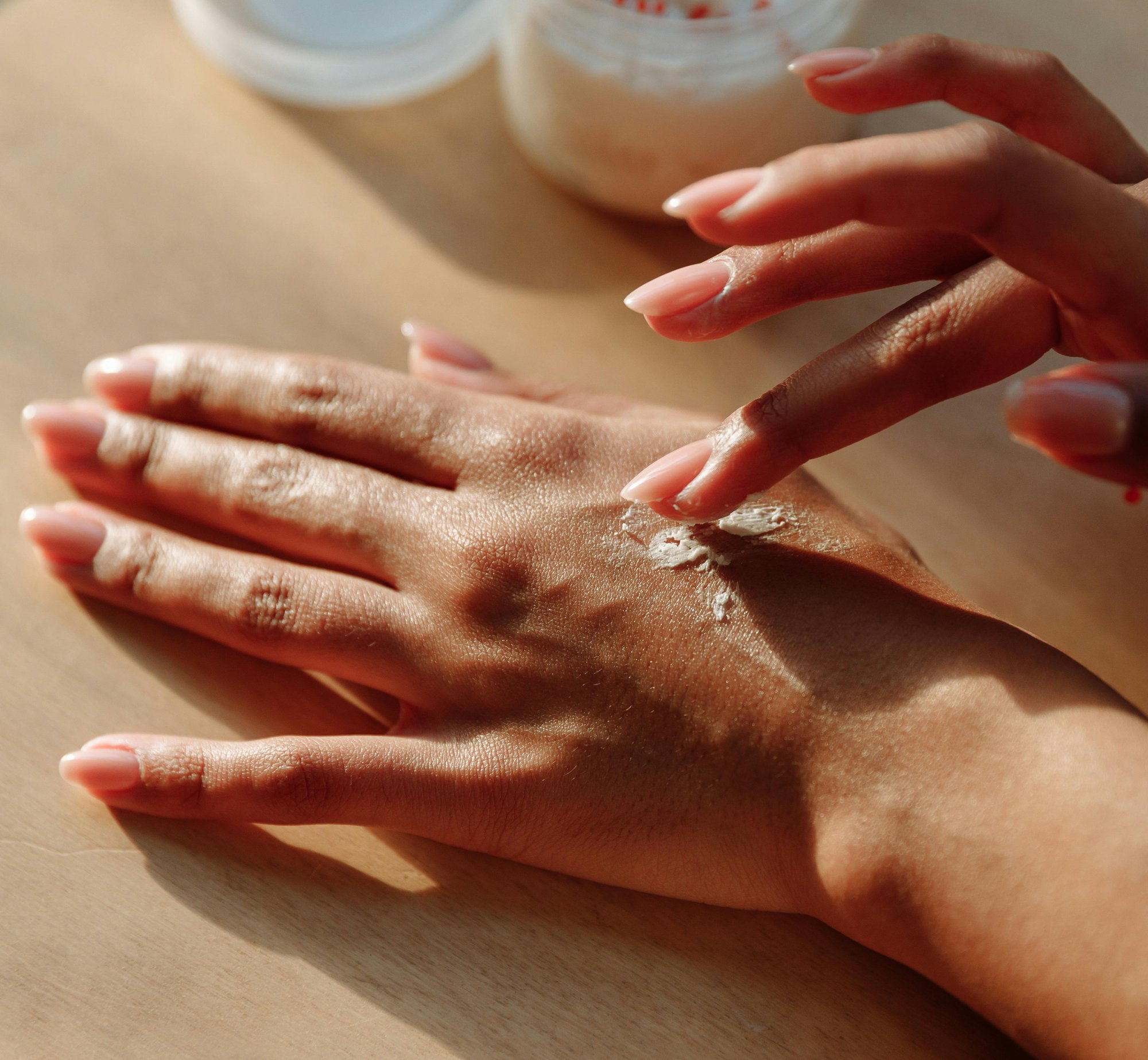 Prečo sú ruky v zime suché a ako ich ochrániť? Top tipy + prírodné zložky, ktoré fungujú