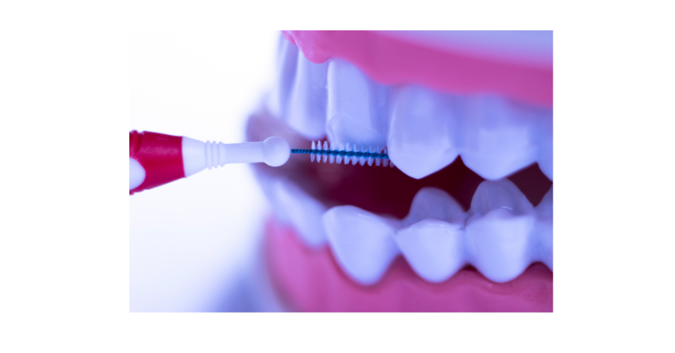 Mezizubní čištění