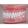8769 Real Series Model stomatologiczny z1111gryz idealny przezroczysty wielkosc naturalna