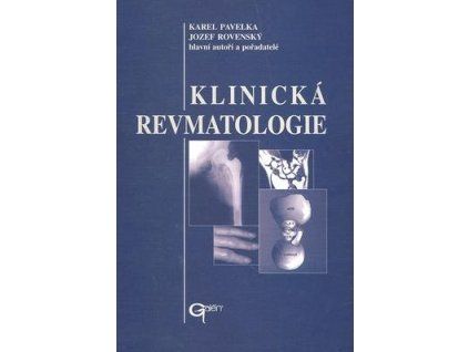 Klinická revmatologie  Klinická revmatologie