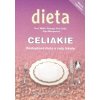Celiakie - Bezlepková dieta a rady lékaře  Celiakie - Bezlepková dieta a rady lékaře   -  Olga Mengerová