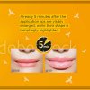 Oh! My Lips Maximizer - Sérum - lesk na zväčšenie pier s včelím jedom